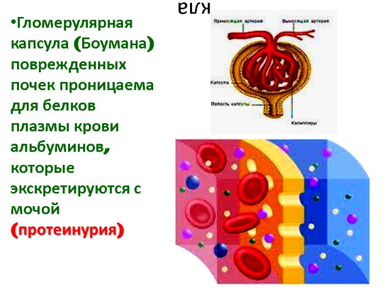 кла Гломерулярная капсула (Боумана) поврежденных почек проницаема для белков плазмы крови альбуминов, которые экскретируются